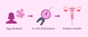 Process of egg donation