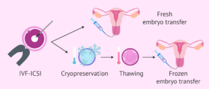 Steps in volved in Frozen embryo transfer 