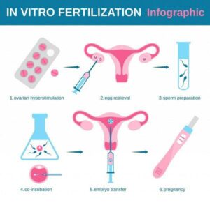 Steps involved in IVF 